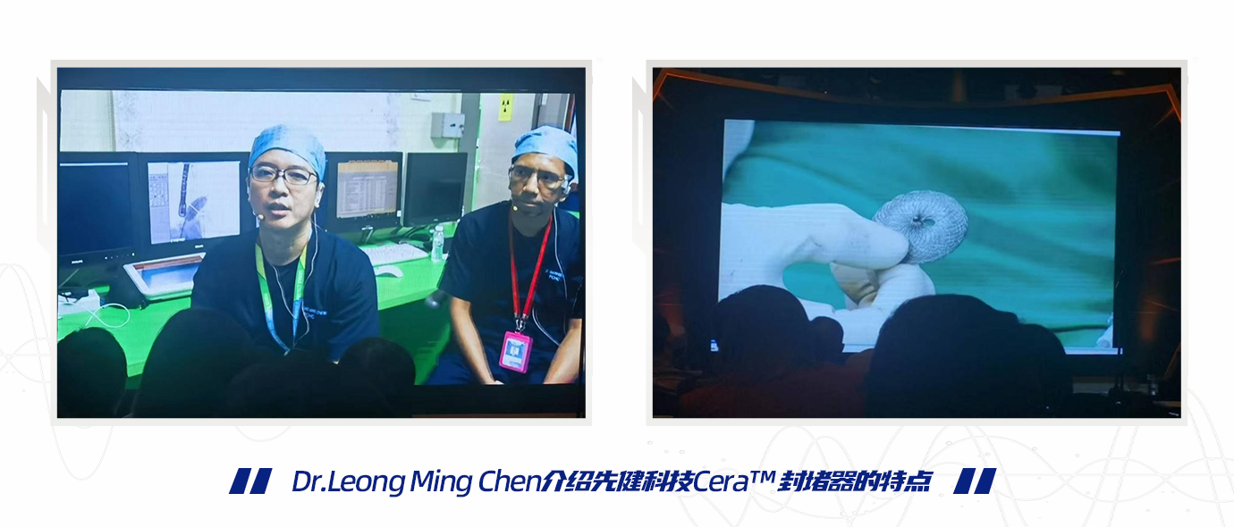 封堵器的特点1.png 封堵器的特点1.png